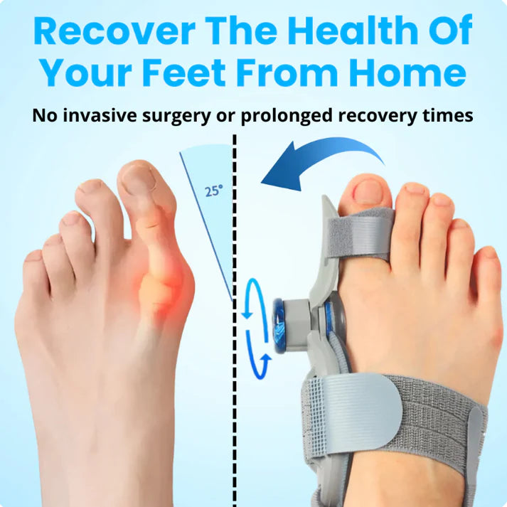 Bonex Bunion Fix - Get Rid of Bunions at Home Without Surgery (Clinically Proven)