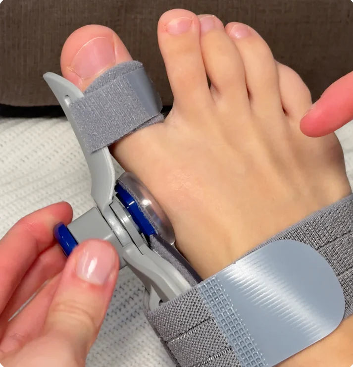 Bonex Bunion Fix - Get Rid of Bunions at Home Without Surgery (Clinically Proven)