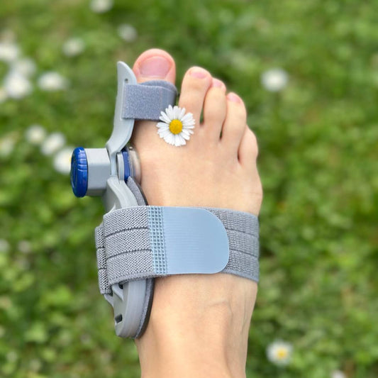 OrtoFix Bunion Corrector – Get Rid of Bunions at Home Without Surgery (Clinically Proven)